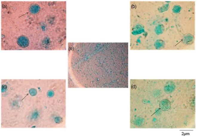 https://cdn.ncbi.nlm.nih.gov/pmc/blobs/17d5/4674020/d15acc709beb/10.1177_2041731415615777-fig4.jpg