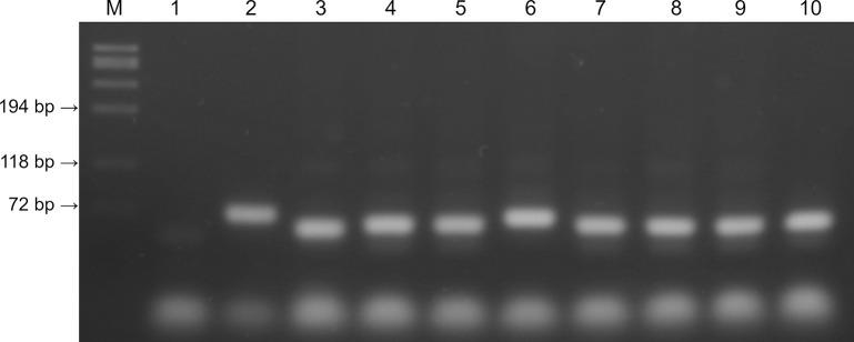 https://cdn.ncbi.nlm.nih.gov/pmc/blobs/17d7/11730420/bfb1de1ba59e/pone.0317104.g001.jpg
