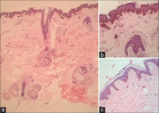 https://cdn.ncbi.nlm.nih.gov/pmc/blobs/17dd/5134163/74b1645a83ac/IDOJ-7-498-g005.jpg