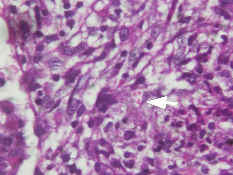 https://cdn.ncbi.nlm.nih.gov/pmc/blobs/17de/4751961/b025a7c2da70/tropmed-94-249-g003.jpg
