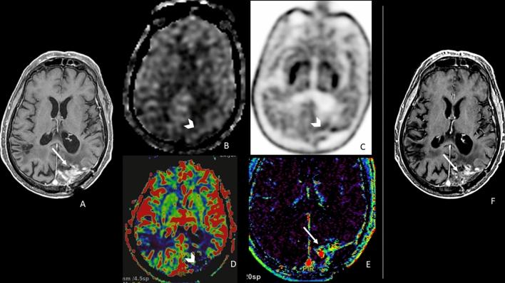 https://cdn.ncbi.nlm.nih.gov/pmc/blobs/17e2/11379733/3573fdd00da3/11547_2024_1862_Fig3_HTML.jpg
