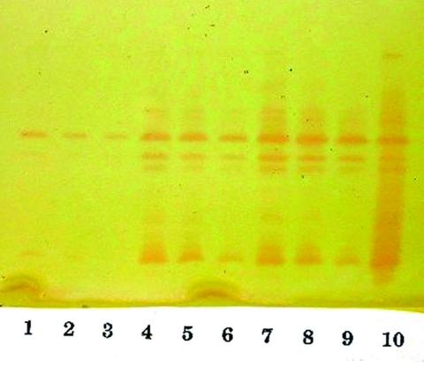 https://cdn.ncbi.nlm.nih.gov/pmc/blobs/17e3/3020613/9ef1f0101e6b/03-0096-F3.jpg