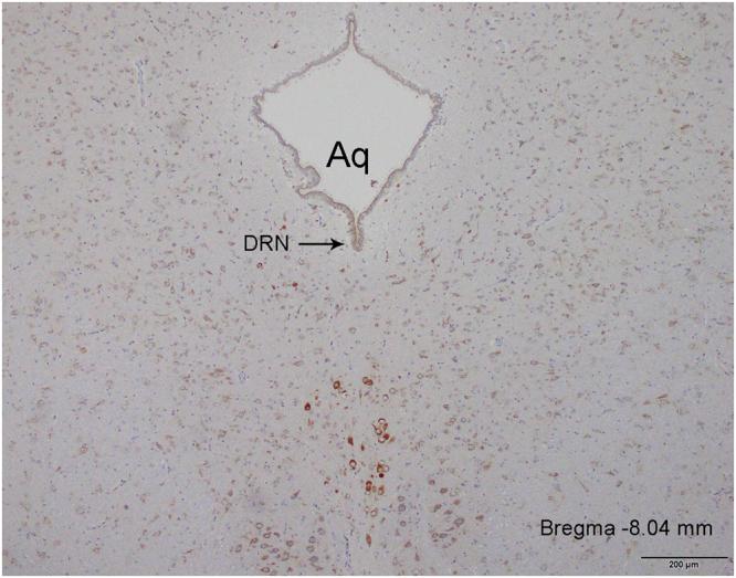 https://cdn.ncbi.nlm.nih.gov/pmc/blobs/17e3/6008476/04a0e992ed4d/41598_2018_27592_Fig1_HTML.jpg
