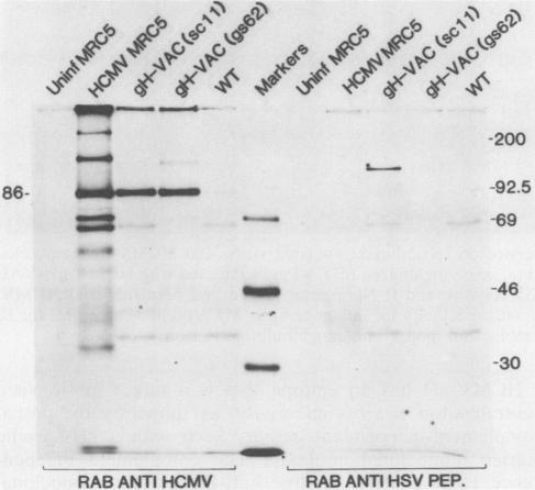 https://cdn.ncbi.nlm.nih.gov/pmc/blobs/17ea/253155/c4b1ee1fe991/jvirol00083-0335-b.jpg