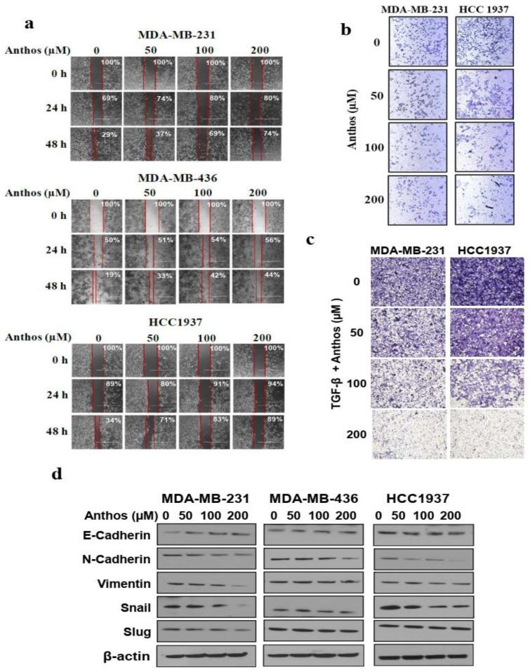 https://cdn.ncbi.nlm.nih.gov/pmc/blobs/17ec/8699375/b48505e56b97/cancers-13-06248-g003.jpg