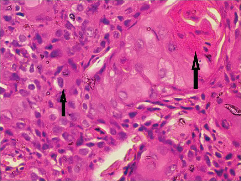 https://cdn.ncbi.nlm.nih.gov/pmc/blobs/17f6/7904020/2e535baded67/JISP-25-61-g003.jpg