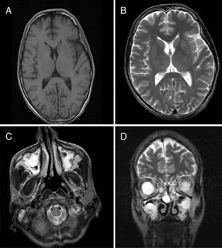https://cdn.ncbi.nlm.nih.gov/pmc/blobs/17f8/8109043/4c8aa2a3d80c/TJO-51-127-g3.jpg
