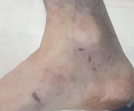 https://cdn.ncbi.nlm.nih.gov/pmc/blobs/17f8/8109043/7b48a67aa1b5/TJO-51-127-g2.jpg