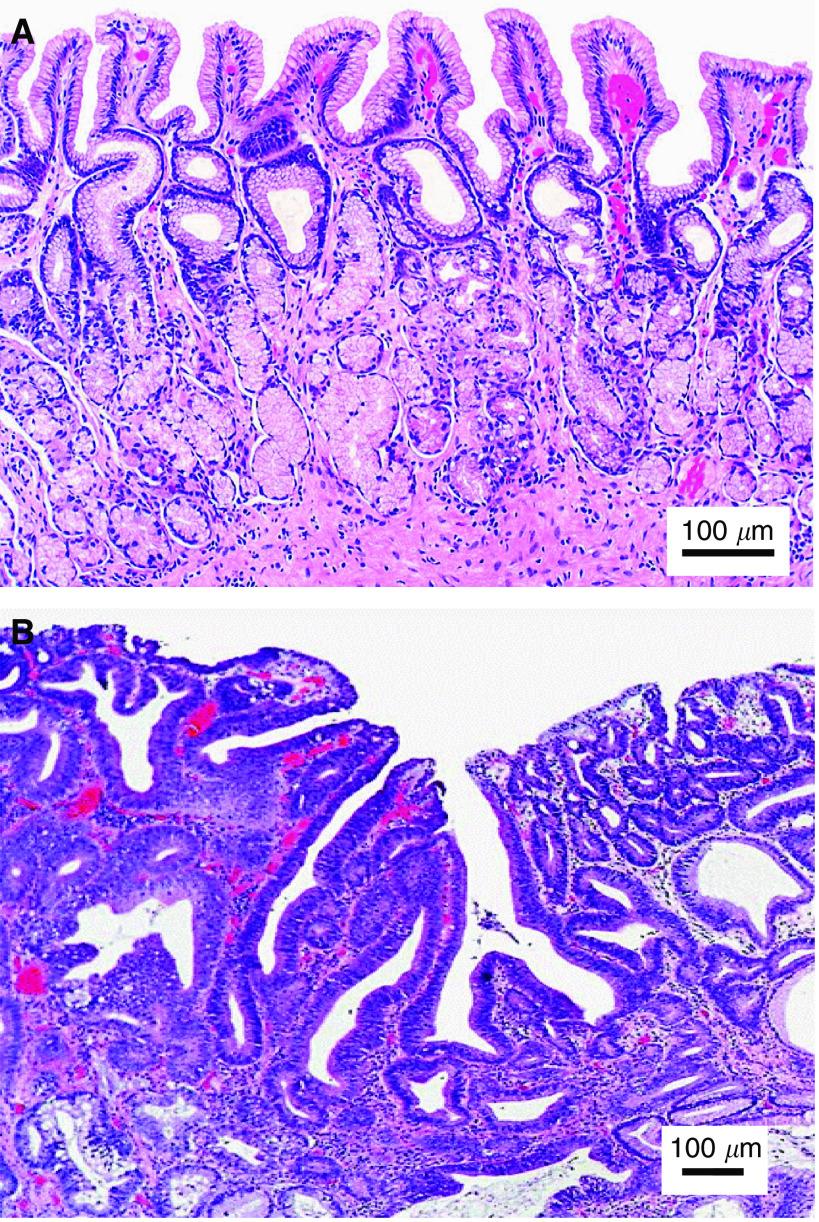 https://cdn.ncbi.nlm.nih.gov/pmc/blobs/17fb/2361456/cccaf475543a/6604176f1.jpg