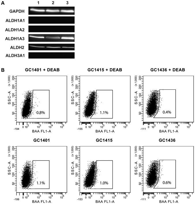 https://cdn.ncbi.nlm.nih.gov/pmc/blobs/17fd/5840753/0ca3ff3589fd/ol-15-04-4849-g03.jpg