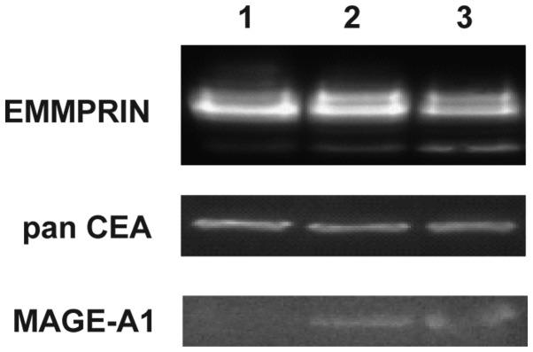 https://cdn.ncbi.nlm.nih.gov/pmc/blobs/17fd/5840753/1e0638ebcd80/ol-15-04-4849-g02.jpg