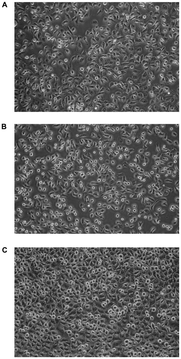 https://cdn.ncbi.nlm.nih.gov/pmc/blobs/17fd/5840753/9c14bdc7af90/ol-15-04-4849-g01.jpg