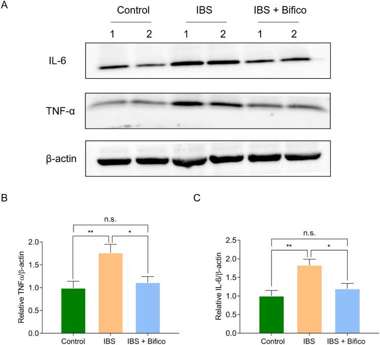 https://cdn.ncbi.nlm.nih.gov/pmc/blobs/1808/9899748/44c33c910fb3/394_2022_2958_Fig6_HTML.jpg