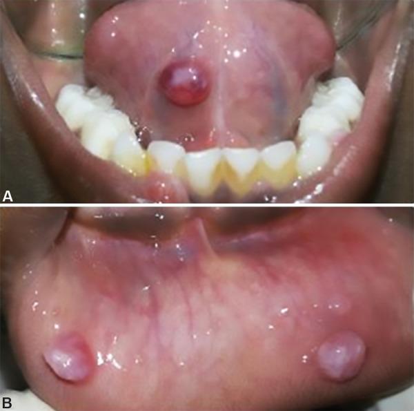 https://cdn.ncbi.nlm.nih.gov/pmc/blobs/180a/6611530/b25199c62abd/ijcpd-11-526-g001.jpg