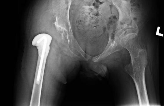 https://cdn.ncbi.nlm.nih.gov/pmc/blobs/1811/8044939/597df693720d/fneur-12-635894-g0002.jpg