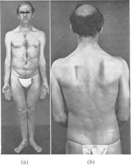 https://cdn.ncbi.nlm.nih.gov/pmc/blobs/1812/492137/039fabddfbc7/jnnpsyc00184-0075-a.jpg