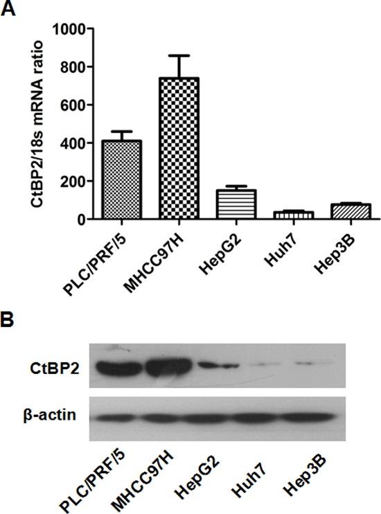 https://cdn.ncbi.nlm.nih.gov/pmc/blobs/1814/4414151/515cea181e24/oncotarget-06-3752-g002.jpg