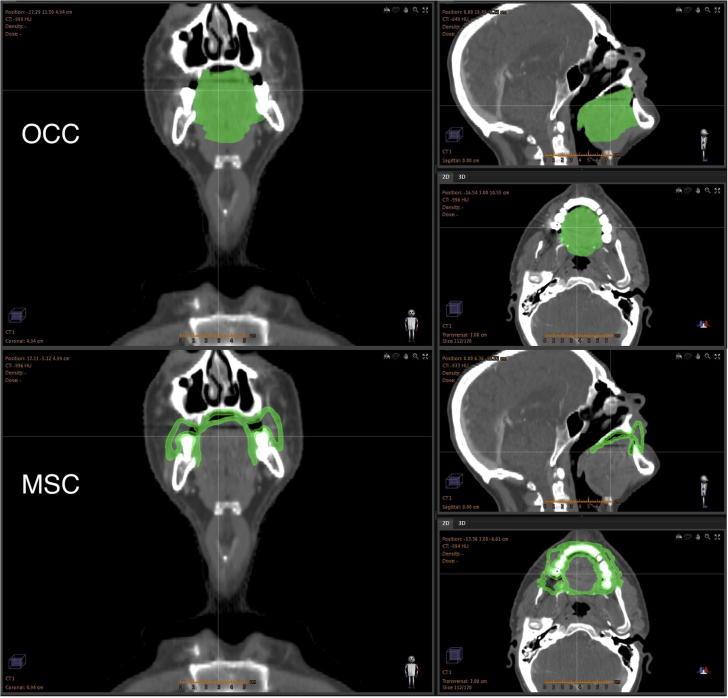 https://cdn.ncbi.nlm.nih.gov/pmc/blobs/1816/4839988/f4cdd71e1bef/gr1.jpg