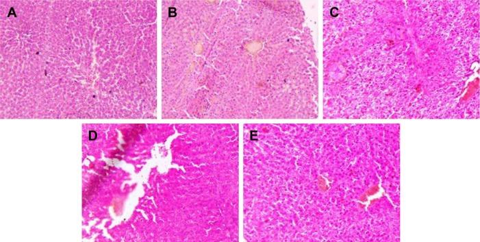 https://cdn.ncbi.nlm.nih.gov/pmc/blobs/1816/5600267/83600f6a1262/ijn-12-6747Fig5.jpg