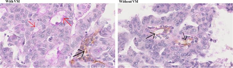 https://cdn.ncbi.nlm.nih.gov/pmc/blobs/181f/7866877/7b774029fa33/12885_2021_7863_Fig2_HTML.jpg