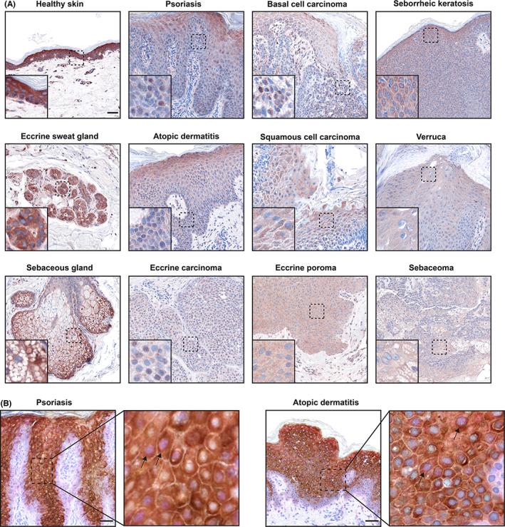 https://cdn.ncbi.nlm.nih.gov/pmc/blobs/1823/9796879/ab2790dae953/EXD-31-1699-g002.jpg