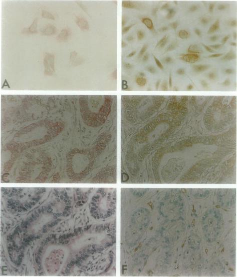 https://cdn.ncbi.nlm.nih.gov/pmc/blobs/1827/1858127/f1ebea710990/amjpathol00013-0097-a.jpg