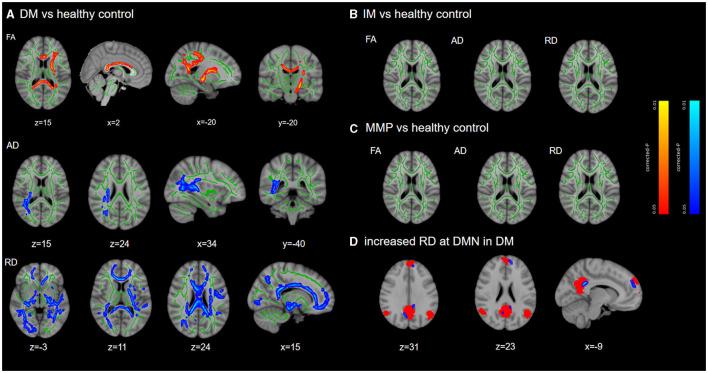 https://cdn.ncbi.nlm.nih.gov/pmc/blobs/1831/11324559/63166d336a17/fnins-18-1439443-g0002.jpg