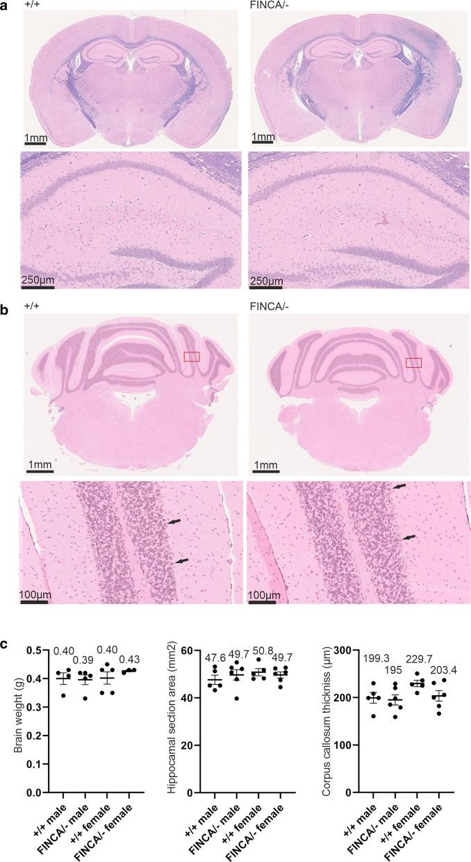https://cdn.ncbi.nlm.nih.gov/pmc/blobs/1832/7724728/265516b4c6bf/10020_2020_245_Fig3_HTML.jpg