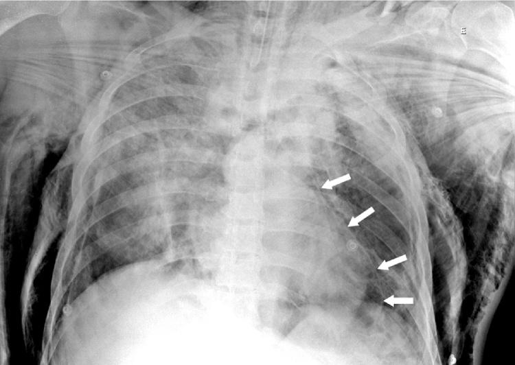 https://cdn.ncbi.nlm.nih.gov/pmc/blobs/1836/4906123/e12e665fc717/gr2.jpg