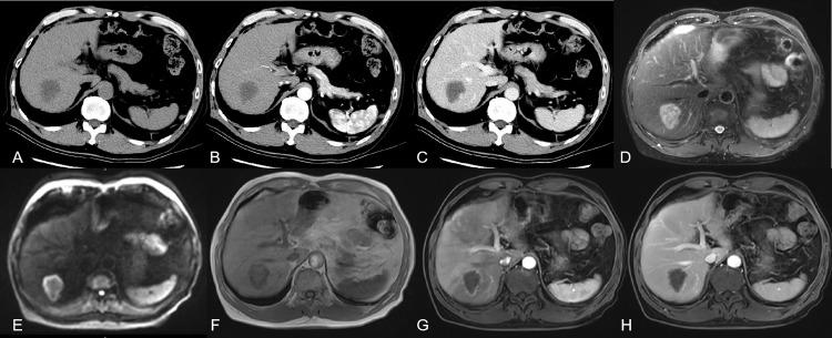 https://cdn.ncbi.nlm.nih.gov/pmc/blobs/1837/9720132/dde8a1168f5e/fonc-12-913806-g001.jpg