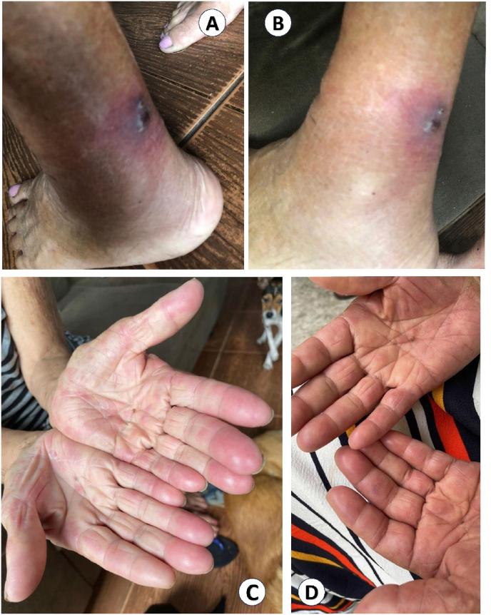 https://cdn.ncbi.nlm.nih.gov/pmc/blobs/1838/11406475/08f5a0e85f68/gr3.jpg