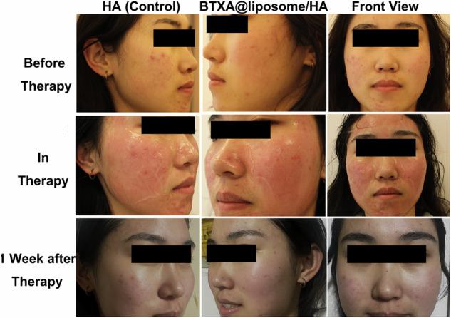 https://cdn.ncbi.nlm.nih.gov/pmc/blobs/183f/11286643/c7762f878d56/10856_2024_6810_Fig5_HTML.jpg