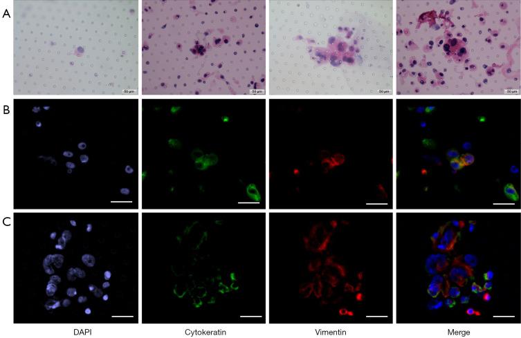 https://cdn.ncbi.nlm.nih.gov/pmc/blobs/1845/9459537/3d3792d369e7/tcr-11-08-2636-f3.jpg