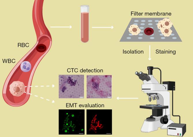 https://cdn.ncbi.nlm.nih.gov/pmc/blobs/1845/9459537/6f0fae3c3852/tcr-11-08-2636-f1.jpg