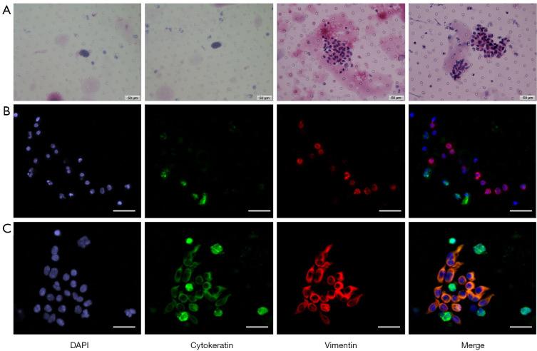 https://cdn.ncbi.nlm.nih.gov/pmc/blobs/1845/9459537/c7c3371bb46a/tcr-11-08-2636-f2.jpg