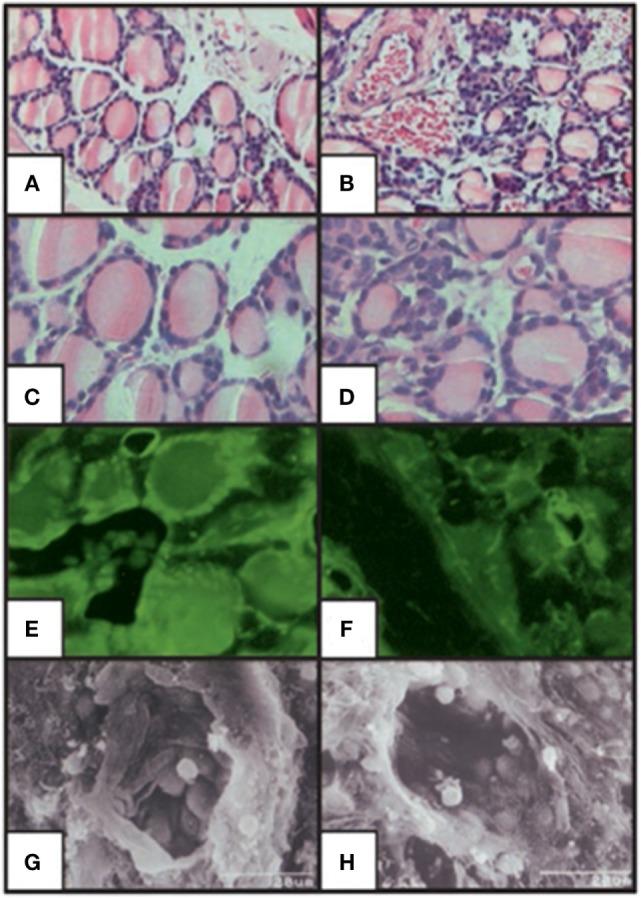 https://cdn.ncbi.nlm.nih.gov/pmc/blobs/1847/5632520/bcc27028f2fd/fendo-08-00252-g004.jpg