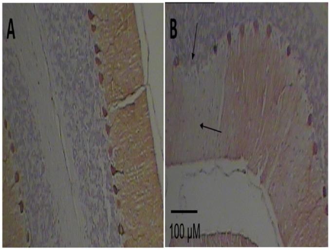 https://cdn.ncbi.nlm.nih.gov/pmc/blobs/184d/6236486/b65e51d16c7b/10.1177_1179066018809091-fig1.jpg