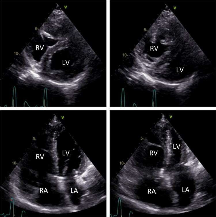 https://cdn.ncbi.nlm.nih.gov/pmc/blobs/1851/10442157/0c85e7e927ea/fcvm-10-1168360-g001.jpg