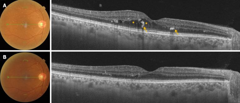 https://cdn.ncbi.nlm.nih.gov/pmc/blobs/1852/11551706/ed2f6f8e87e7/99235-g002.jpg
