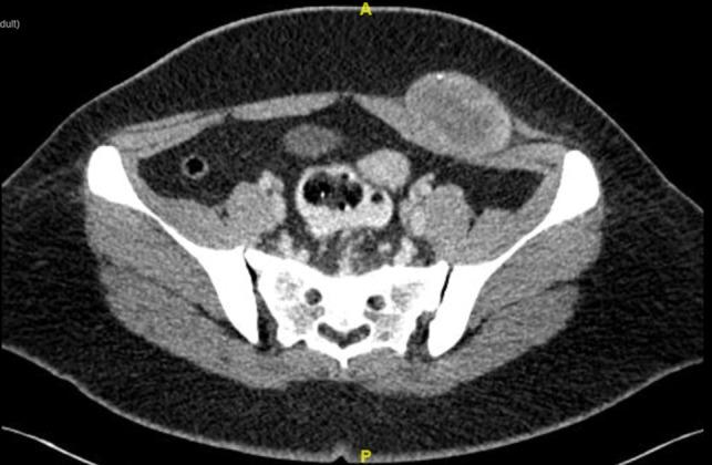 https://cdn.ncbi.nlm.nih.gov/pmc/blobs/1852/6368141/ed74124ffb4f/rjy345f01.jpg