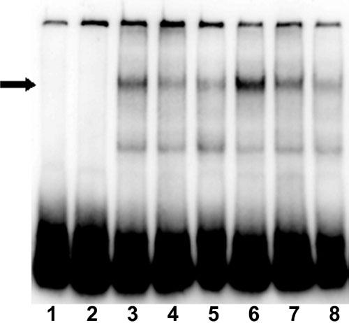 https://cdn.ncbi.nlm.nih.gov/pmc/blobs/185b/2503184/a713464c7588/mv-v13-66-f9.jpg