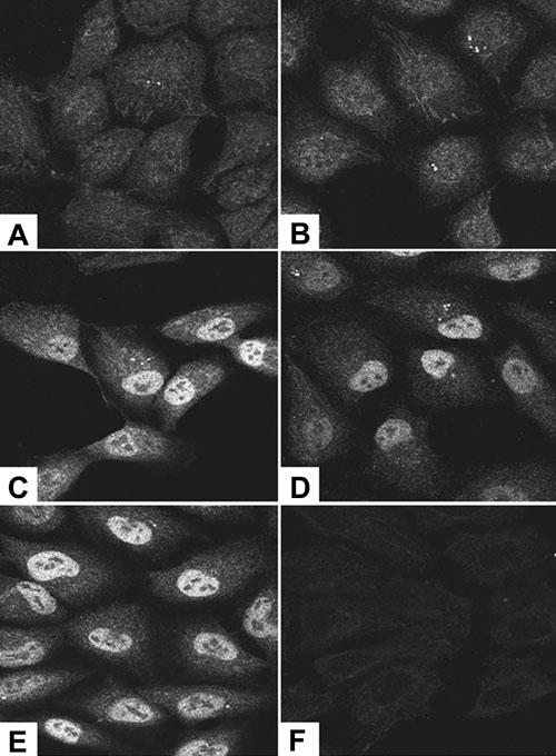 https://cdn.ncbi.nlm.nih.gov/pmc/blobs/185b/2503184/cc882486f502/mv-v13-66-f12.jpg