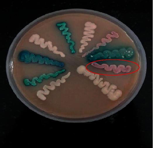 https://cdn.ncbi.nlm.nih.gov/pmc/blobs/185d/7785382/df419527d4e4/CRIID2020-8847853.003.jpg
