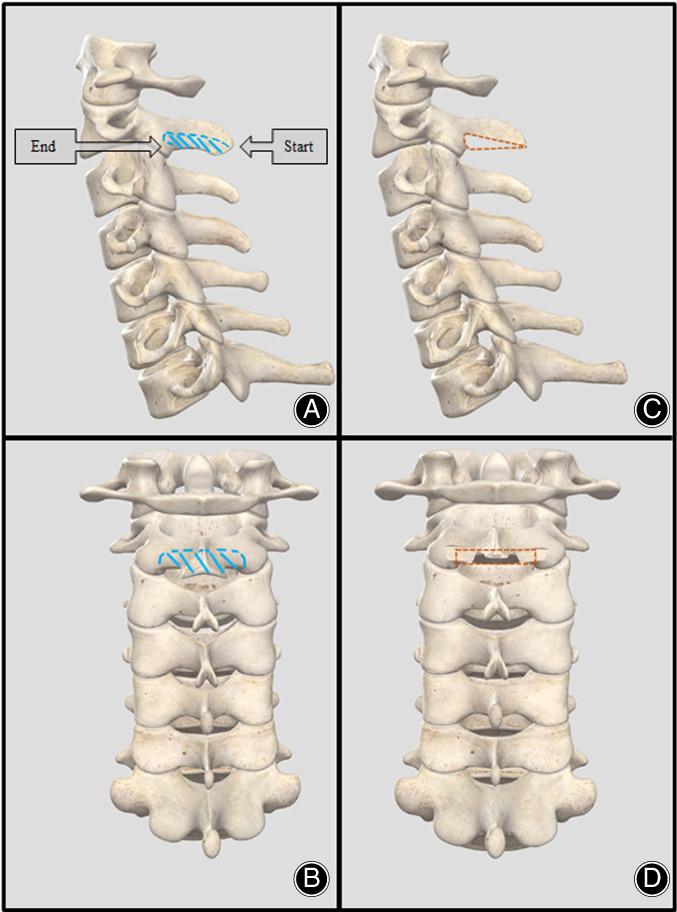 https://cdn.ncbi.nlm.nih.gov/pmc/blobs/185f/7862153/57ab329d2f4c/OS-13-161-g001.jpg