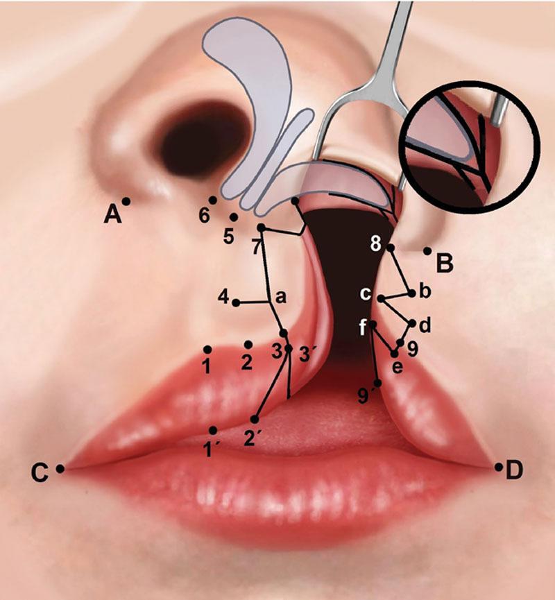 https://cdn.ncbi.nlm.nih.gov/pmc/blobs/1863/7489733/413ad4889632/gox-8-e3044-g002.jpg