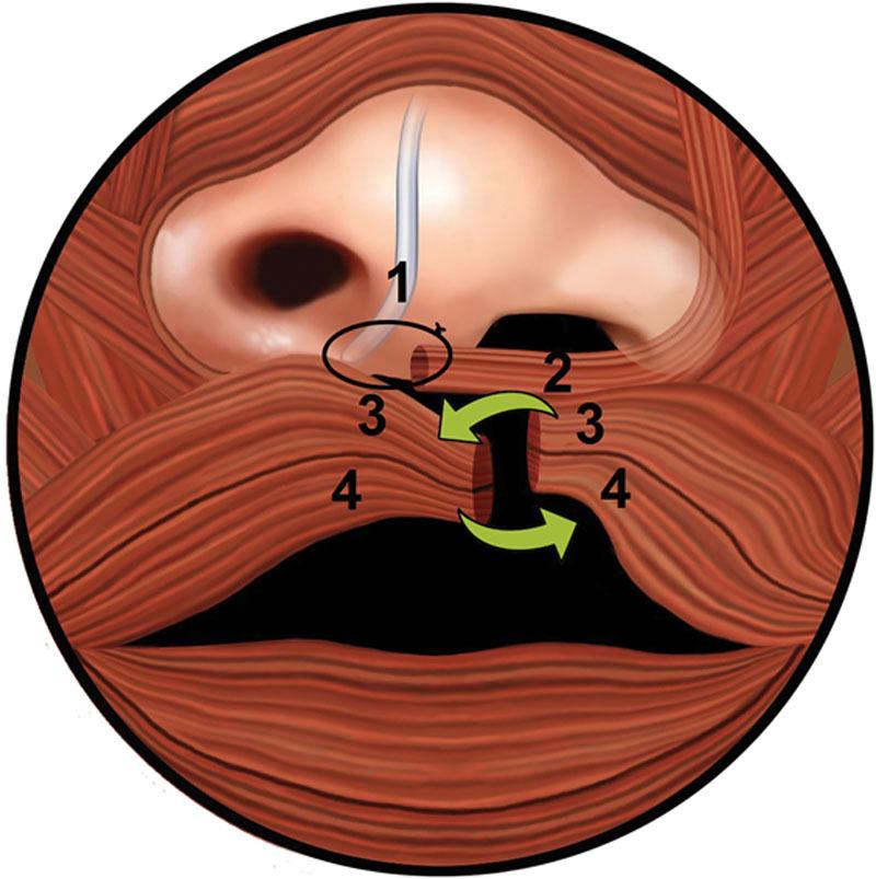 https://cdn.ncbi.nlm.nih.gov/pmc/blobs/1863/7489733/79aa980be0a6/gox-8-e3044-g008.jpg