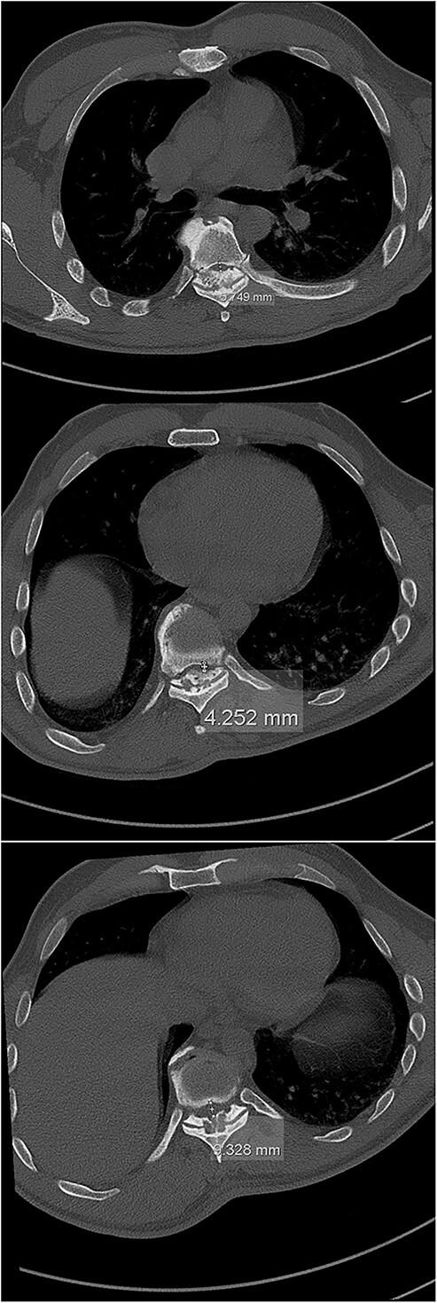 https://cdn.ncbi.nlm.nih.gov/pmc/blobs/1864/9950717/70904f39d71a/rjad070f2.jpg