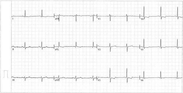 https://cdn.ncbi.nlm.nih.gov/pmc/blobs/1866/2847255/b56812ac9ea6/TOCMJ-4-57_F1.jpg