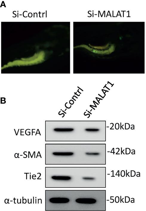 https://cdn.ncbi.nlm.nih.gov/pmc/blobs/1866/8529043/427b1dccf60e/fonc-11-742789-g006.jpg