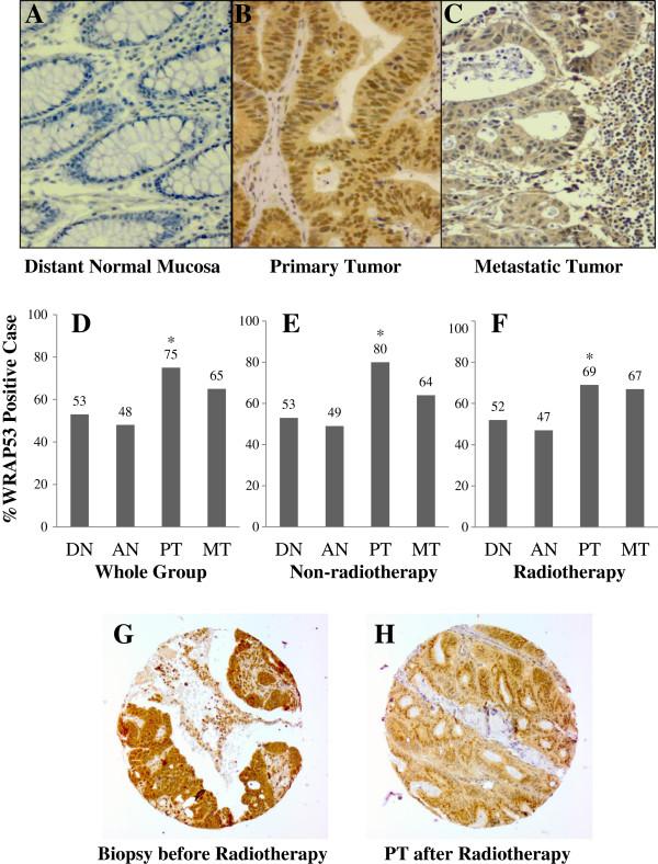 https://cdn.ncbi.nlm.nih.gov/pmc/blobs/186c/3504514/a84c9a4c59b8/1471-2407-12-294-2.jpg